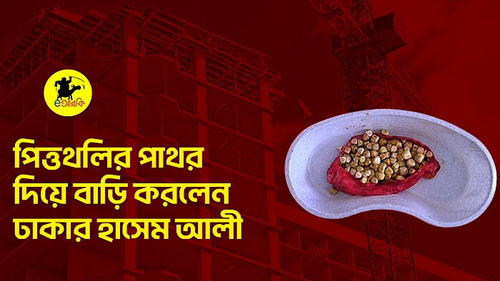 পিত্তথলির পাথর দিয়ে বাড়ি করলেন ঢাকার হাসেম আলী
