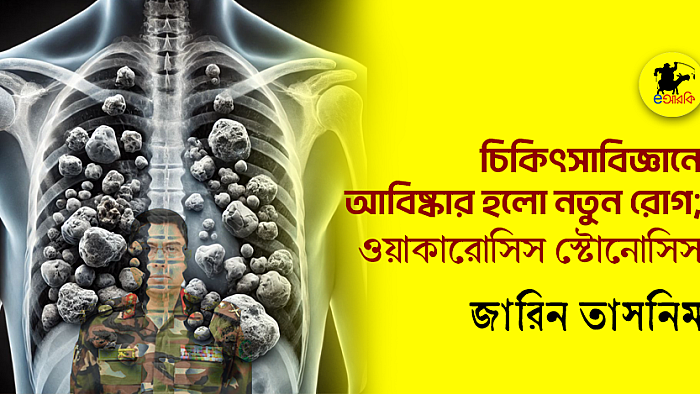 চিকিৎসাবিজ্ঞানে আবিষ্কার হলো নতুন রোগ; ওয়াকারোসিস স্টোনোসিস