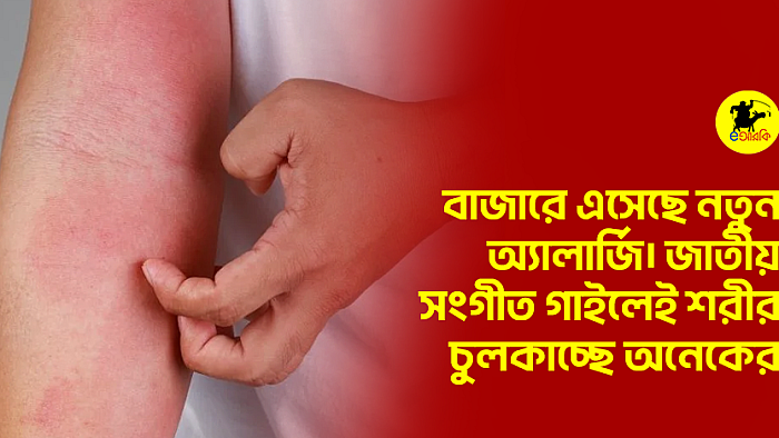 বাজারে এসেছে নতুন অ্যালার্জি। জাতীয় সংগীত গাইলেই শরীর চুলকাচ্ছে অনেকের