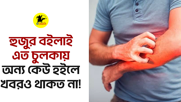 হুজুর বইলাই এত চুলকায়, অন্য কেউ হইলে খবরও থাকত না!